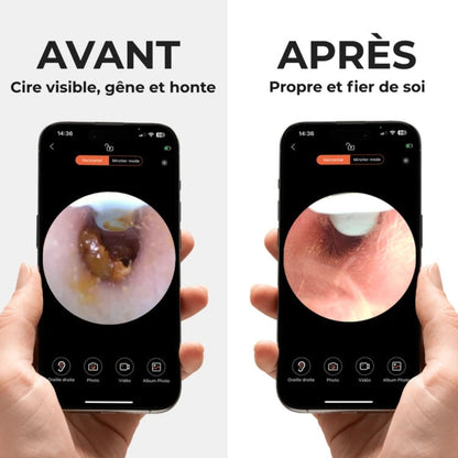 Cure-oreille caméra